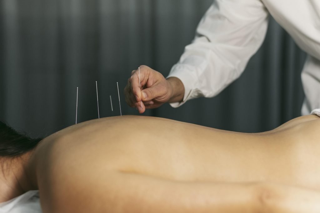 Acupuncturist in hoogvliet